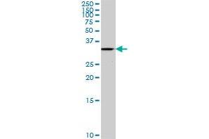 ALS2CR7 polyclonal antibody (A01), Lot # CRU5060602QCS1. (Cyclin-Dependent Kinase 15 (ALS2CR7) (AA 242-347) antibody)