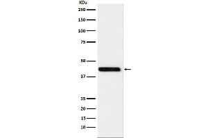 Western blot analysis of Cystathionase expression in HeLa cell lysate.