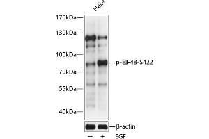 Western blot analysis of extracts of HeLa cells, using Phospho-EIF4B-S422 antibody (ABIN6135212, ABIN6136060, ABIN6136061 and ABIN6225673) at 1:2000 dilution. (EIF4B antibody  (pSer422))