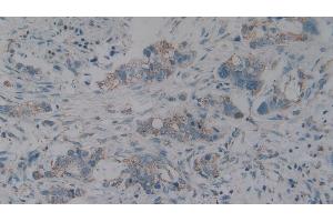 Immunohistochemistry (IHC) image for anti-Complement Component 1, Q Subcomponent Binding Protein (C1QBP) (AA 76-282) antibody (ABIN7432316)