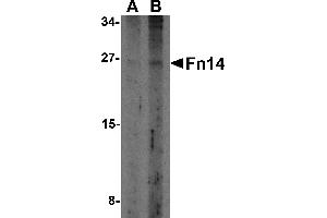 Western Blotting (WB) image for anti-Tumor Necrosis Factor Receptor Superfamily, Member 12A (TNFRSF12A) antibody (ABIN1031803) (TNFRSF12A antibody)