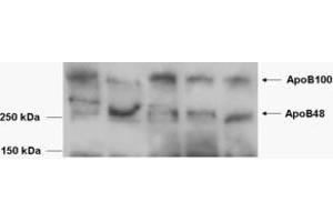 EB08792 (0. (APOB antibody  (Internal Region))