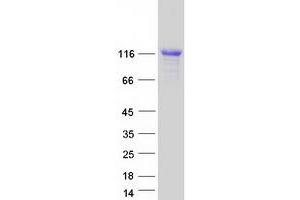 Validation with Western Blot (Calpastatin Protein (CAST) (Transcript Variant 10) (Myc-DYKDDDDK Tag))