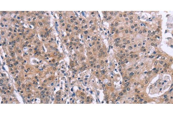 GPR172B antibody
