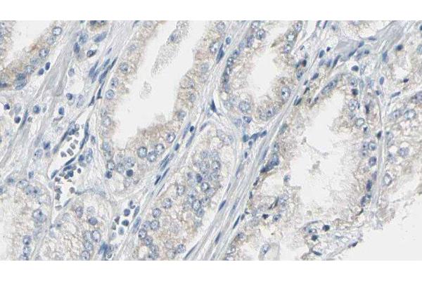CEP170 antibody  (Internal Region)