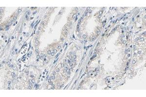 ABIN6274988 at 1/100 staining Human prostate tissue by IHC-P. (CEP170 antibody  (Internal Region))