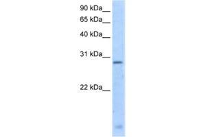 Western Blotting (WB) image for anti-Regulator of G-Protein Signalling 18 (RGS18) antibody (ABIN2462635) (RGS18 antibody)