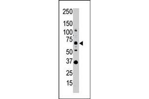 Western blot analysis of SENP1 polyclonal antibody  in whole HL-60 cell lysate : SENP1 (Arrow) was detected using purified polyclonal antibody. (SENP1 antibody  (N-Term))