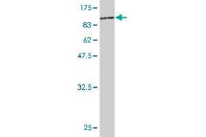 Western Blot detection against Immunogen (85. (Phosphoglucomutase 3 antibody  (AA 1-542))