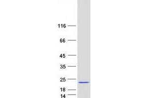 LSM1 Homolog, U6 Small Nuclear RNA Associated (LSM1) protein (Myc-DYKDDDDK Tag)