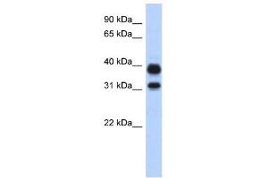 CHIA antibody  (N-Term)