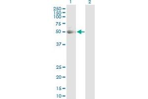Western Blot analysis of KRT7 expression in transfected 293T cell line by KRT7 MaxPab polyclonal antibody. (Cytokeratin 7 antibody  (AA 1-469))