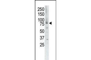 Western blot analysis of anti-MUSK Pab in placenta cell lysate (MUSK antibody  (C-Term))