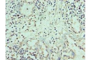 Immunohistochemistry of paraffin-embedded human prostate tissue using ABIN7173794 at dilution of 1:100