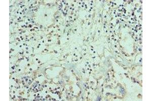 Immunohistochemistry of paraffin-embedded human prostate tissue using ABIN7173794 at dilution of 1:100 (TWEAK antibody  (AA 42-123))