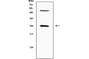 anti-Cytotoxic T-Lymphocyte-Associated Protein 4 (CTLA4) (AA 36-161) antibody