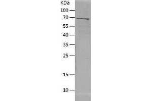 Western Blotting (WB) image for Arylacetamide Deacetylase (Esterase) (AADAC) (AA 24-399) protein (His-IF2DI Tag) (ABIN7285688) (AADAC Protein (AA 24-399) (His-IF2DI Tag))