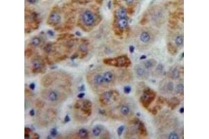 Used in DAB staining on fromalin fixed paraffin-embedded Liver tissue (ANXA6 antibody  (AA 251-504))