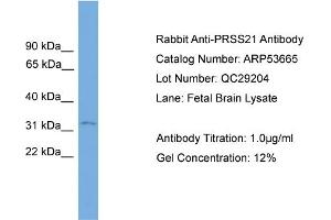 WB Suggested Anti-PRSS21  Antibody Titration: 0. (PRSS21 antibody  (N-Term))