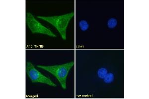 ABIN1590057 Immunofluorescence analysis of paraformaldehyde fixed HeLa cells, permeabilized with 0. (TNNI3 antibody  (AA 117-127))