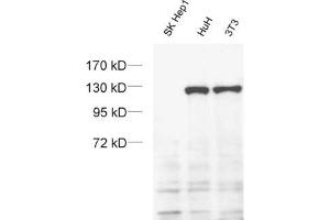 dilution: 1 : 1000 (ECL), sample: SK-Hep1 cell with a homozygous deletion of exportin 4.