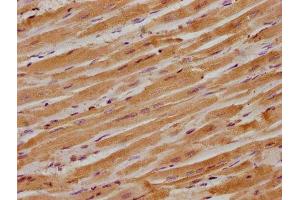 IHC image of ABIN7156473 diluted at 1:300 and staining in paraffin-embedded human heart tissue performed on a Leica BondTM system. (ITGB1BP1 antibody  (AA 1-200))