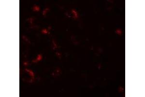 Immunofluorescencent staining of human brain cells with AXIN1 polyclonal antibody  at 20 ug/mL. (Axin antibody  (C-Term))