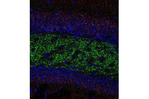 Indirect immunofluorescence labeling of PFA fixed, paraffin embedded mouse hippocampus section with anti-ZnT 3 (dilution 1 : 500; green) and rabbit anti-VGluT 2 (, dilution 1 : 500; red).