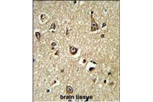 Immunohistochemistry (Paraffin-embedded Sections) (IHC (p)) image for anti-phosphoglycerate Dehydrogenase (PHGDH) (AA 140-168), (N-Term) antibody (ABIN389483)