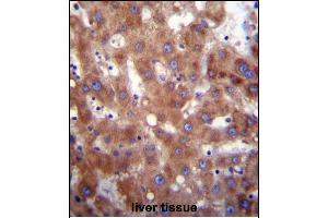HSD17B4 Antibody (Center) (ABIN656447 and ABIN2845732) immunohistochemistry analysis in formalin fixed and paraffin embedded human liver tissue followed by peroxidase conjugation of the secondary antibody and DAB staining. (HSD17B4 antibody  (AA 341-370))