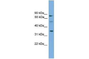 WB Suggested Anti-OSTalpha Antibody Titration: 0. (OST alpha antibody  (Middle Region))