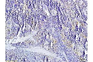 Formalin-fixed and paraffin-embedded: rat spleen tissue labeled with Rabbit Anti-TNFSF14 Polyclonal Antibody, Unconjugated (ABIN740625) 1:200 followed by conjugation to the secondary antibody and DAB staining