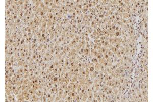 ABIN6276502 at 1/100 staining Rat liver tissue by IHC-P. (PPP1CB antibody)