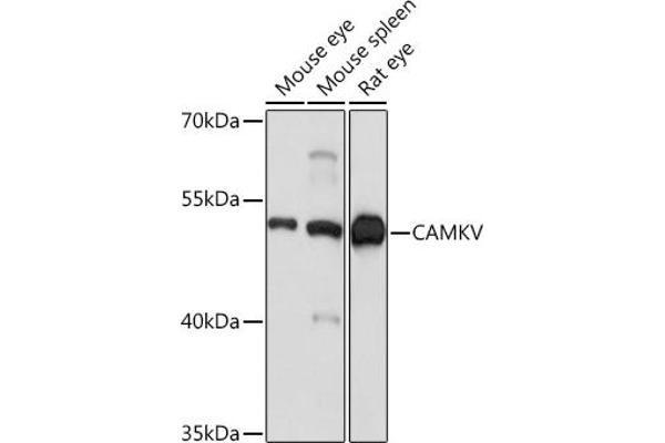 CAMKV antibody  (AA 1-285)