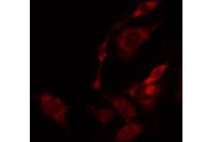 ABIN6274831 staining Hela by IF/ICC. (ACER2 antibody)