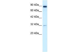 WB Suggested Anti-MMP9 Antibody Titration:  1. (MMP 9 antibody  (N-Term))