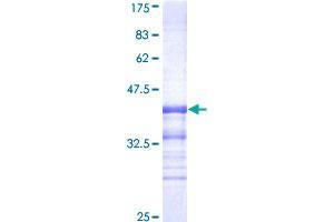 CDK8 Protein (AA 375-464) (GST tag)