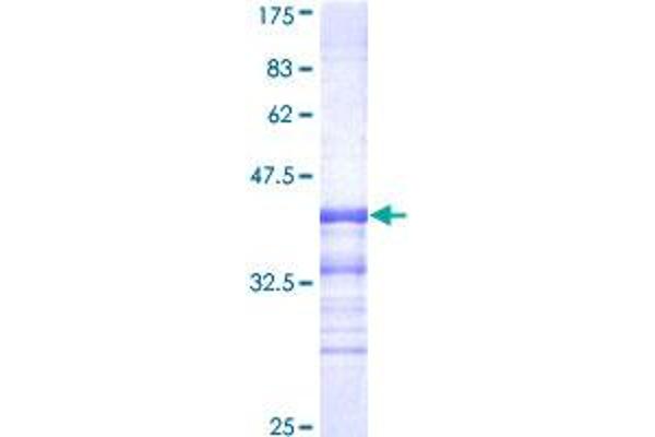 CDK8 Protein (AA 375-464) (GST tag)