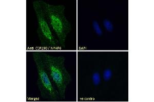 CEP290 antibody  (Internal Region)