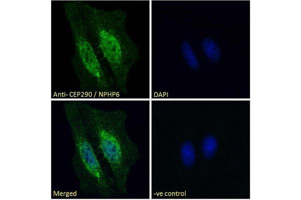 CEP290 antibody  (Internal Region)