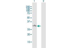 Western Blot analysis of NSMCE2 expression in transfected 293T cell line by NSMCE2 MaxPab polyclonal antibody. (NSMCE2 antibody  (AA 1-247))