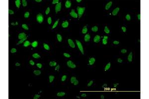 Immunofluorescence of monoclonal antibody to NFX1 on HeLa cell. (NFX1 antibody  (AA 981-1080))