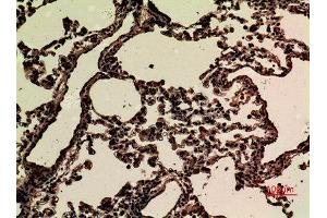 Immunohistochemistry (IHC) analysis of paraffin-embedded Rat Lung, antibody was diluted at 1:100.