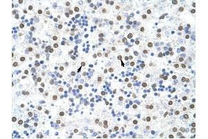 MSI2 antibody was used for immunohistochemistry at a concentration of 4-8 ug/ml to stain Hepatocytes (arrows) in Human Liver. (MSI2 antibody)