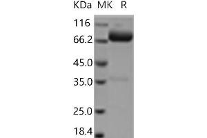 Western Blotting (WB) image for CD14 (CD14) protein (Fc Tag) (ABIN7194697) (CD14 Protein (CD14) (Fc Tag))