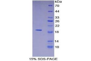 SDS-PAGE (SDS) image for Thrombomodulin (THBD) (AA 31-169) protein (His tag) (ABIN1099500)
