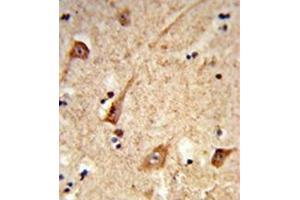 Immunohistochemistry analysis in formalin-fixed and paraffin-embedded human brain tissue reacted with GALNT2 Antibody (N-term) followed which was peroxidase-conjugated to the secondary antibody, followed by DAB staining. (GALNT2 antibody  (N-Term))