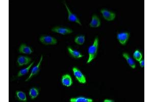 Immunofluorescent analysis of A549 cells using ABIN7146487 at dilution of 1:100 and Alexa Fluor 488-congugated AffiniPure Goat Anti-Rabbit IgG(H+L) (Calmodulin 1 antibody  (AA 2-149))