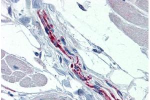 Human Heart, Nerve (formalin-fixed, paraffin-embedded) stained with TH antibody ABIN364267 at 1:100 followed by biotinylated goat anti-rabbit IgG secondary antibody ABIN481713, alkaline phosphatase-streptavidin and chromogen.