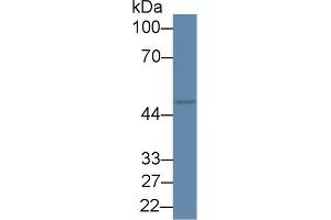 Detection of RIPK2 in Rat Placenta lysate using Polyclonal Antibody to Receptor Interacting Serine Threonine Kinase 2 (RIPK2) (RIPK2 antibody  (AA 1-294))